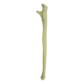 1002 - LEFT ULNA