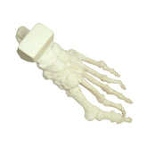 1006-01 - LEFT FOOT WITH DEFORMITIES