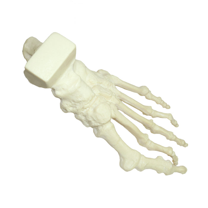 1006-01 - LEFT FOOT WITH DEFORMITIES