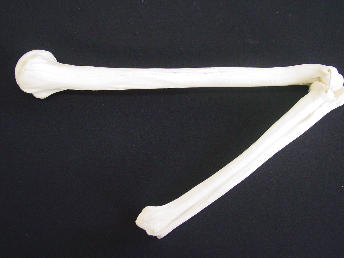 12337 - RADIOPAQUE LEFT ELBOW (IMP.)