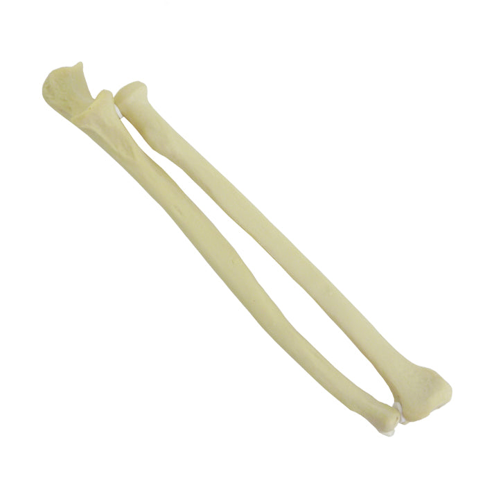 12339 - RADIOPAQUE LEFT FOREARM