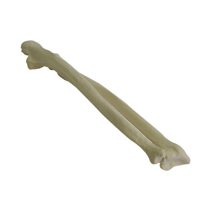 12338 - RADIOPAQUE RIGHT FOREARM