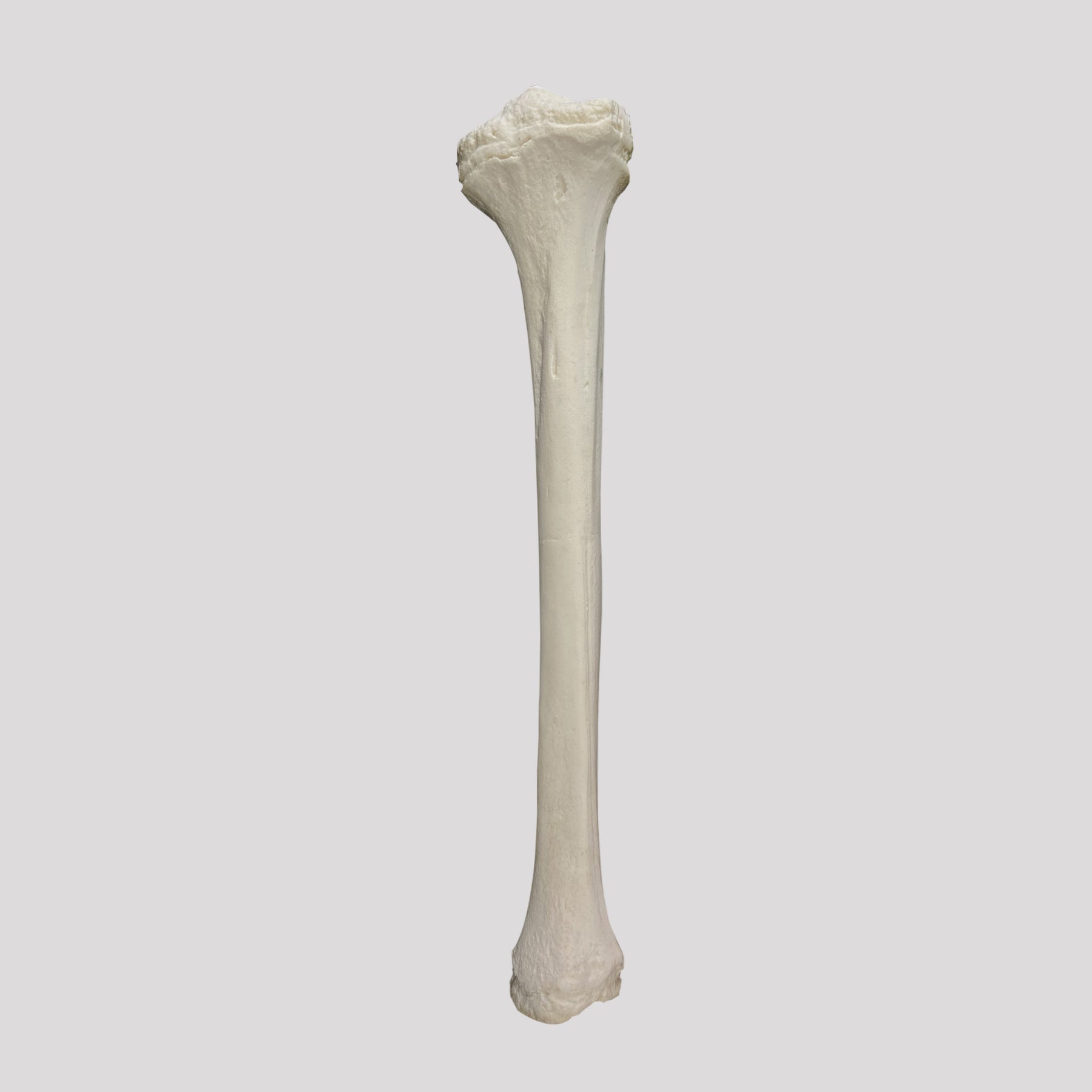 1015 - RIGHT PEDIATRIC TIBIA