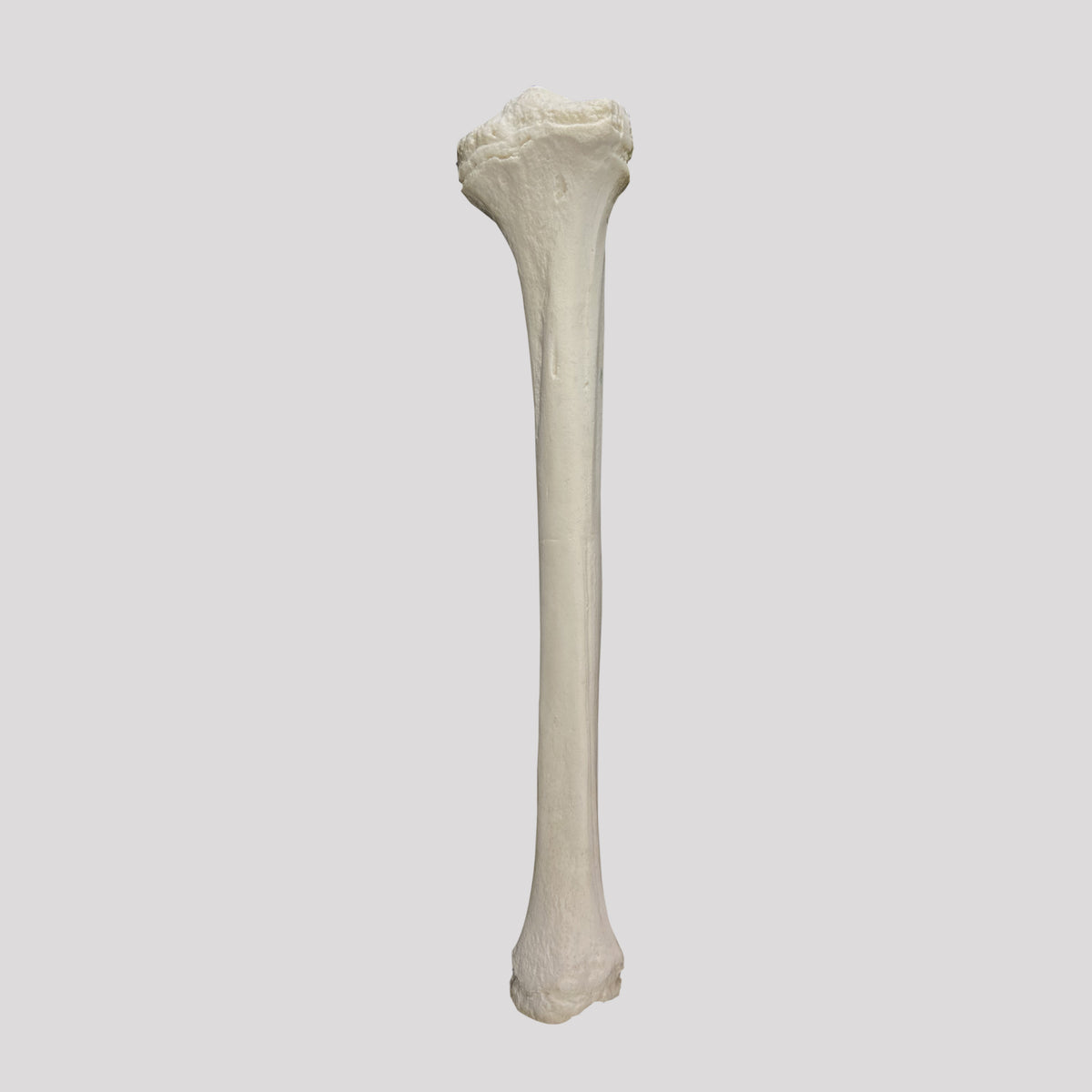 12374 - RADIOPAQUE RIGHT PEDIATRIC TIBIA
