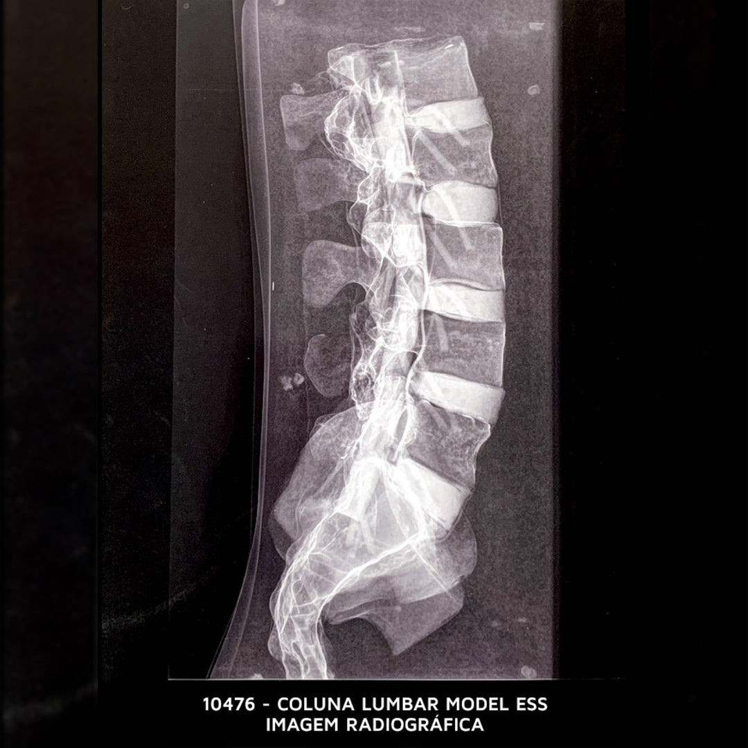 10476 - LUMBAR MODEL ESS