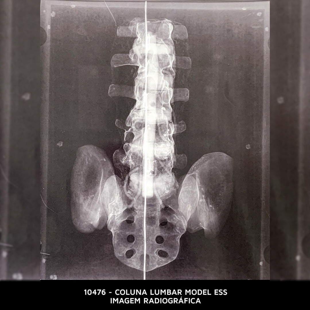 10476 - LUMBAR MODEL ESS