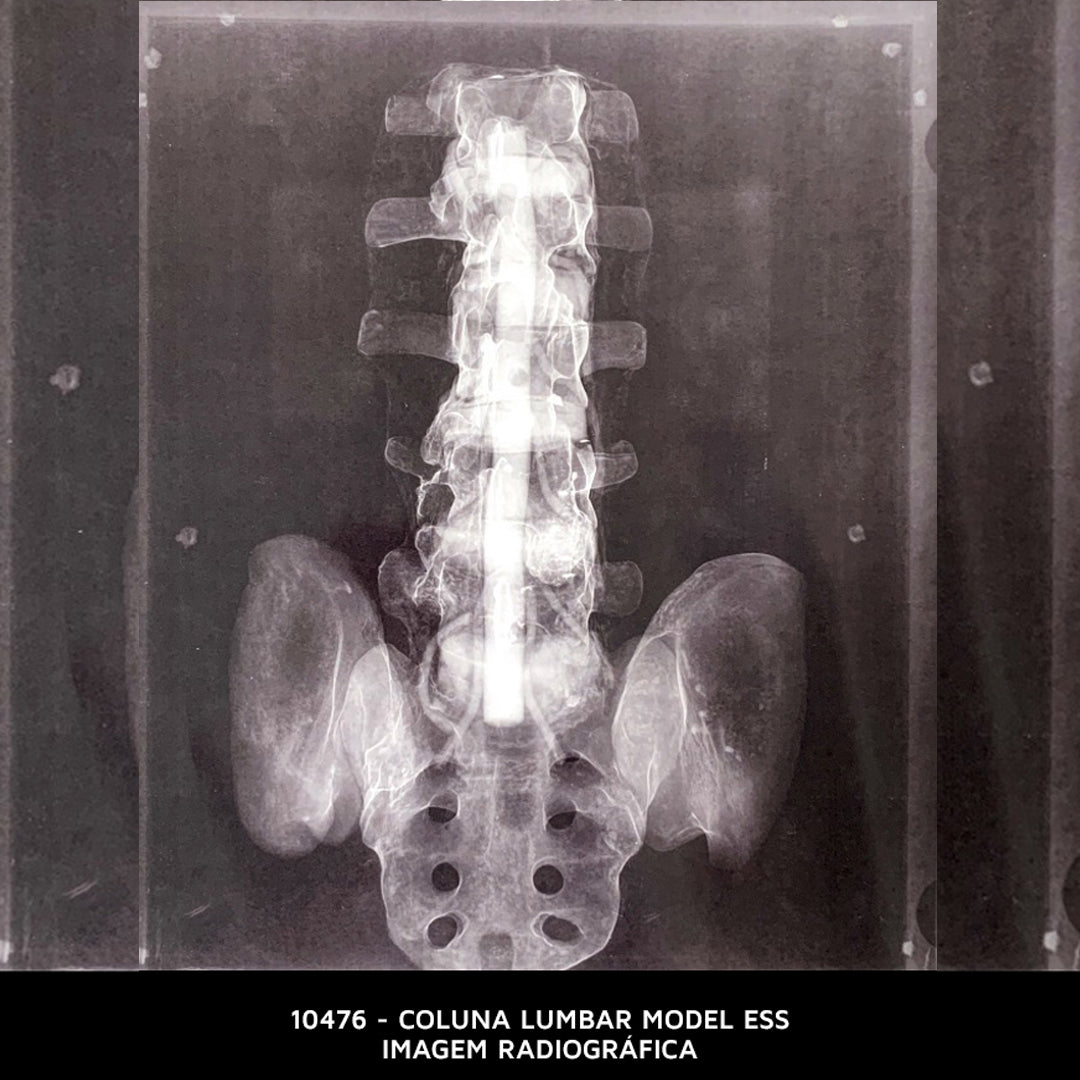10476 - LUMBAR MODEL ESS