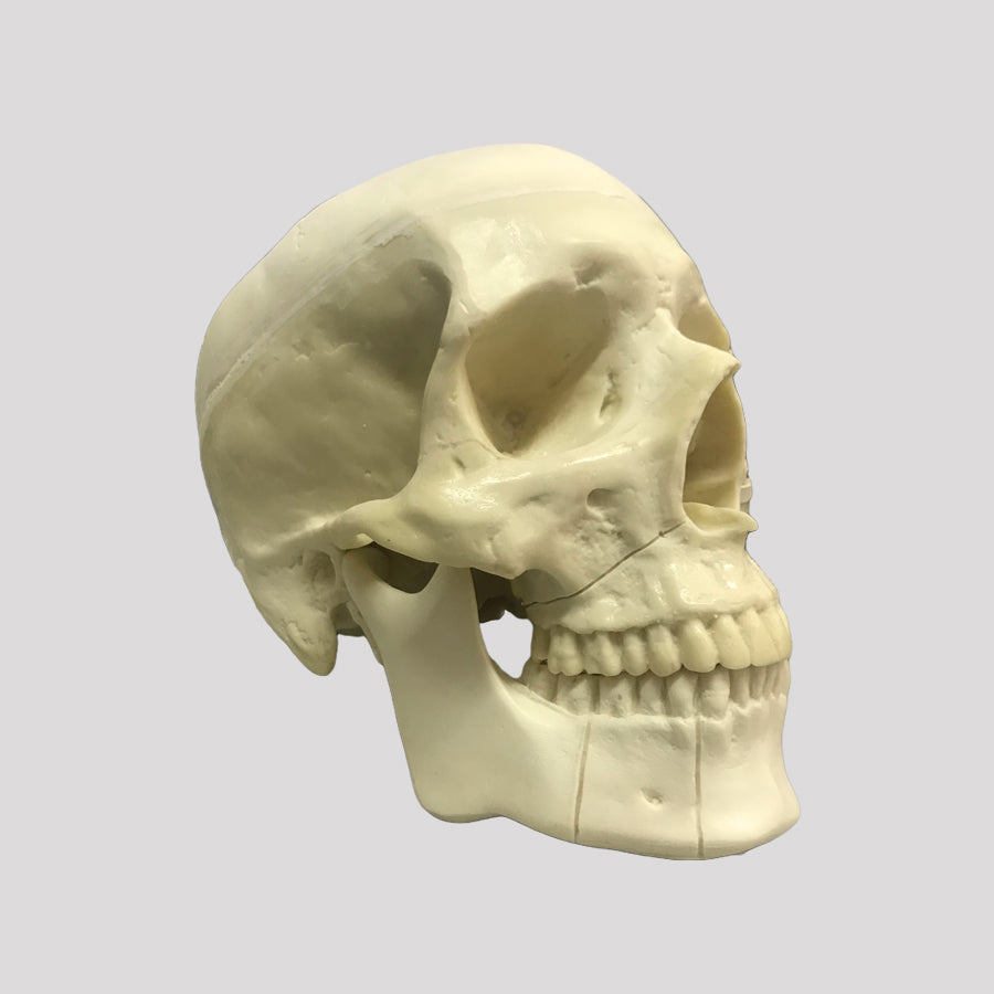 10985 SKULL WITH ZYGOMATIC FRACTURE AND SUPPORT BLOCK