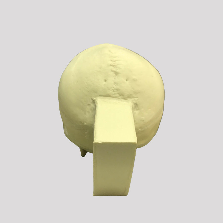 10985 SKULL WITH ZYGOMATIC FRACTURE AND SUPPORT BLOCK