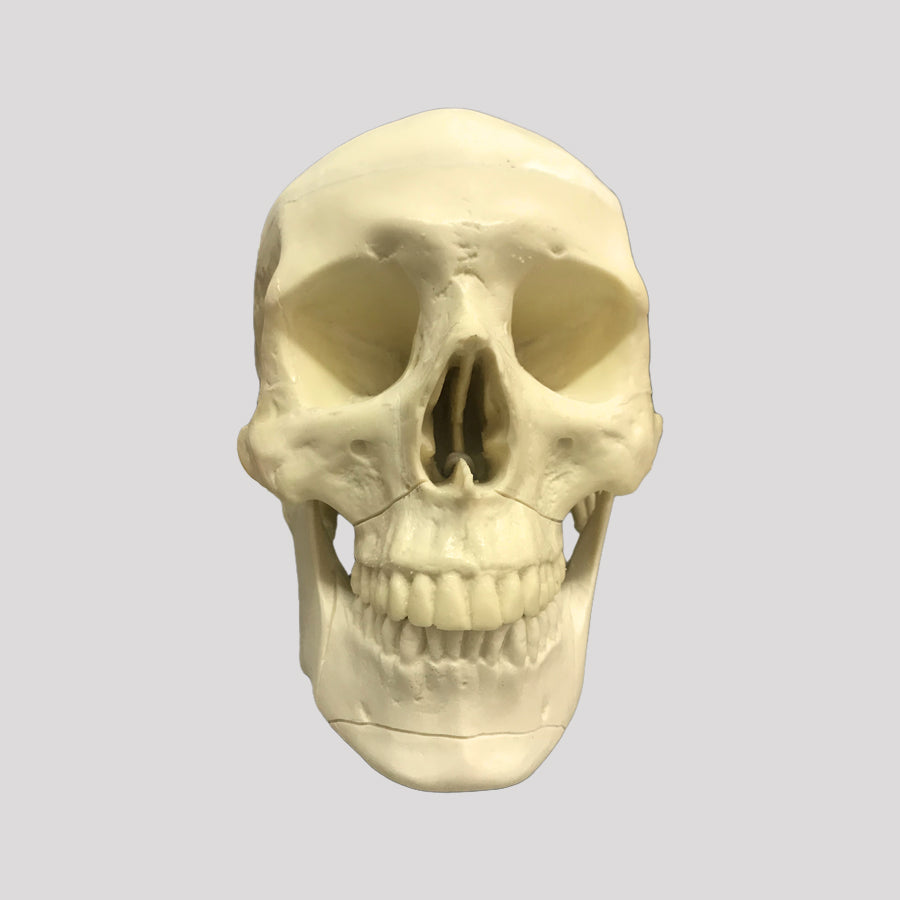 10986 - SKULL WITH LE FORT FRACTURE AND SUPPORT BLOCK