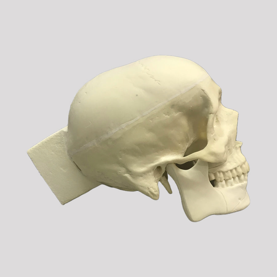 10986 - SKULL WITH LE FORT FRACTURE AND SUPPORT BLOCK