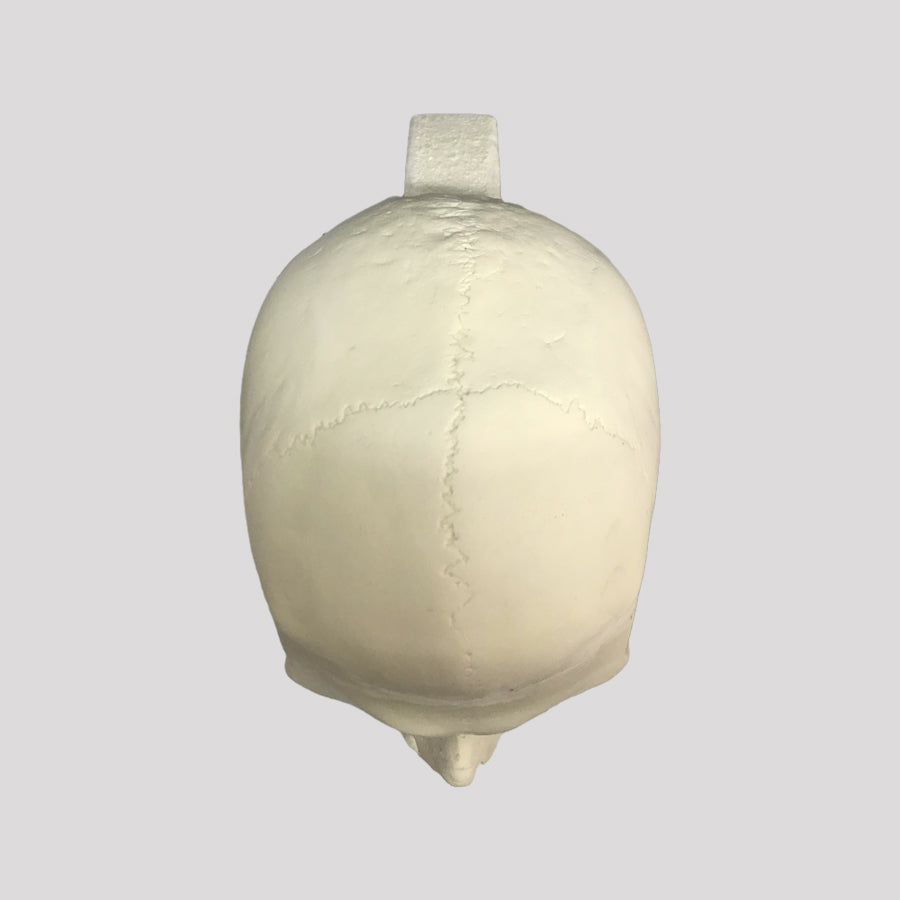 10986 - SKULL WITH LE FORT FRACTURE AND SUPPORT BLOCK