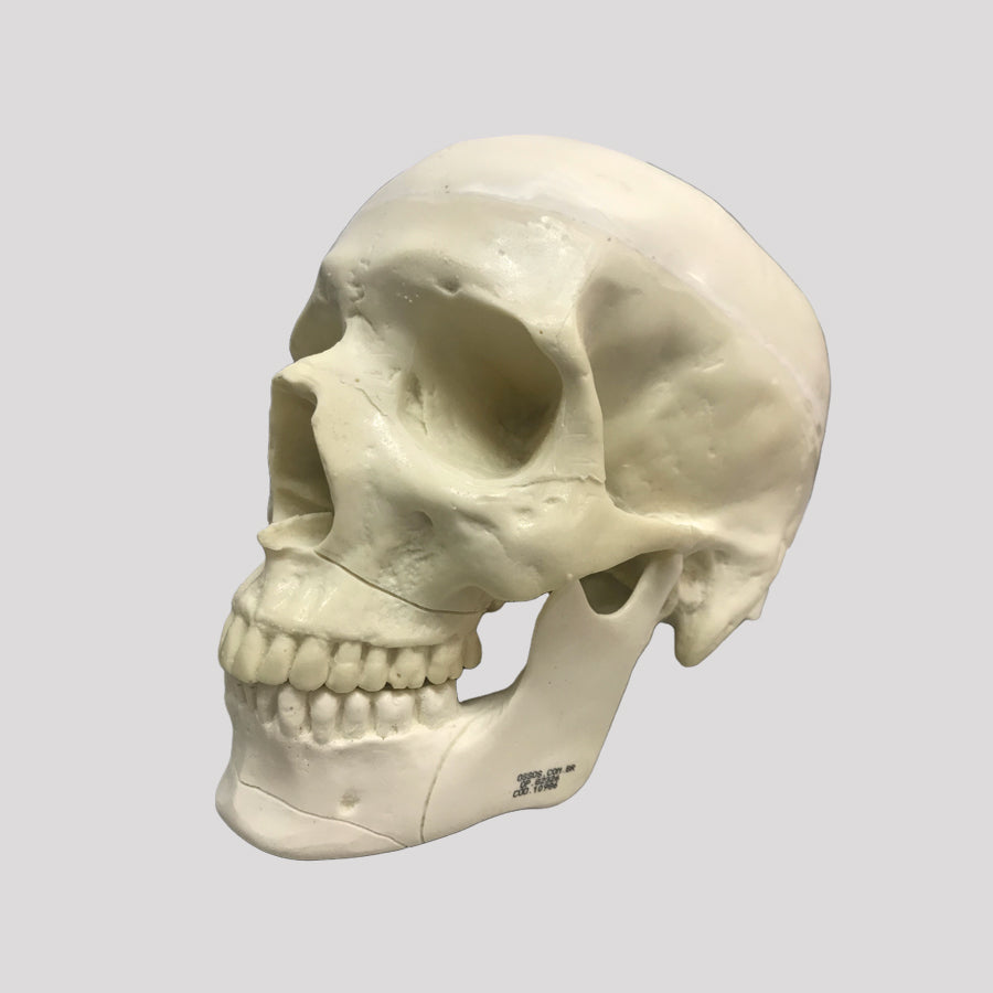 10986 - SKULL WITH LE FORT FRACTURE AND SUPPORT BLOCK
