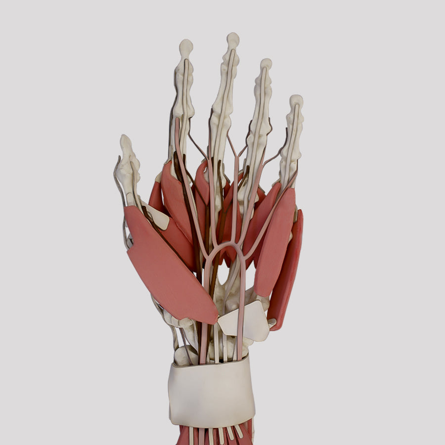 11292 - LEFT WRIST WITH COMPLETE STRUCTURES