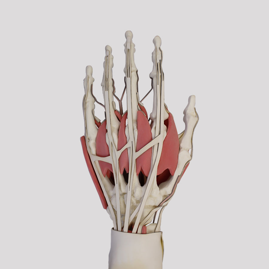 11292 - LEFT WRIST WITH COMPLETE STRUCTURES