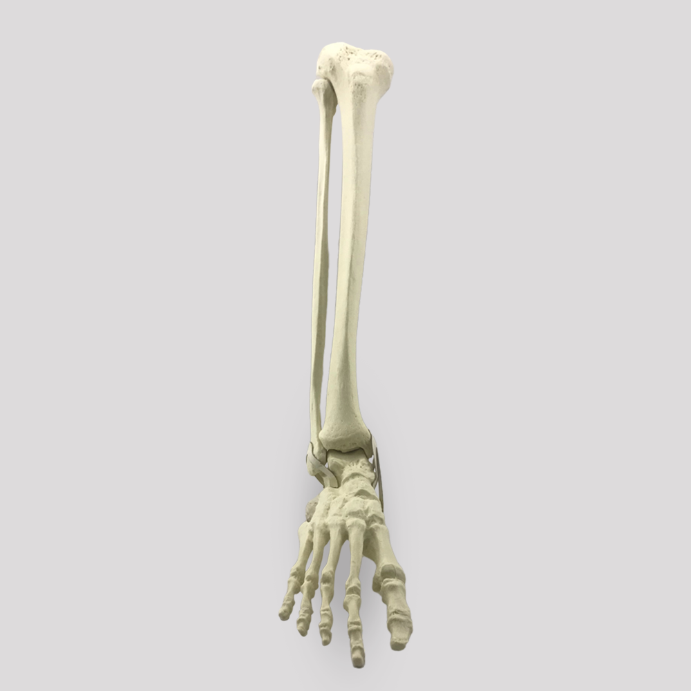 11920 - RIGHT ANKLE