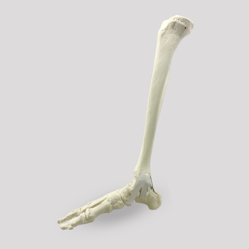 11920 - RIGHT ANKLE