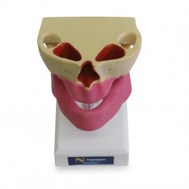 4007G - EDENTULOUS MODEL WITH GUM