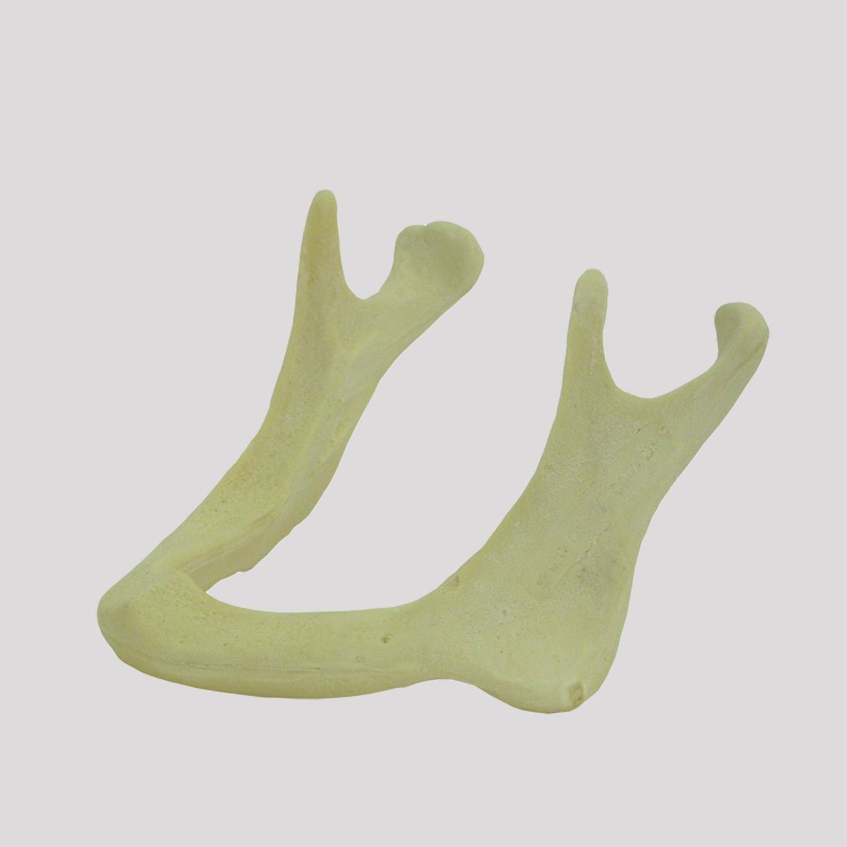 4010 AT - 03B - RADIOPAQUE EDENTULA JAW WITH BONE RESORPTION III (10 MM)