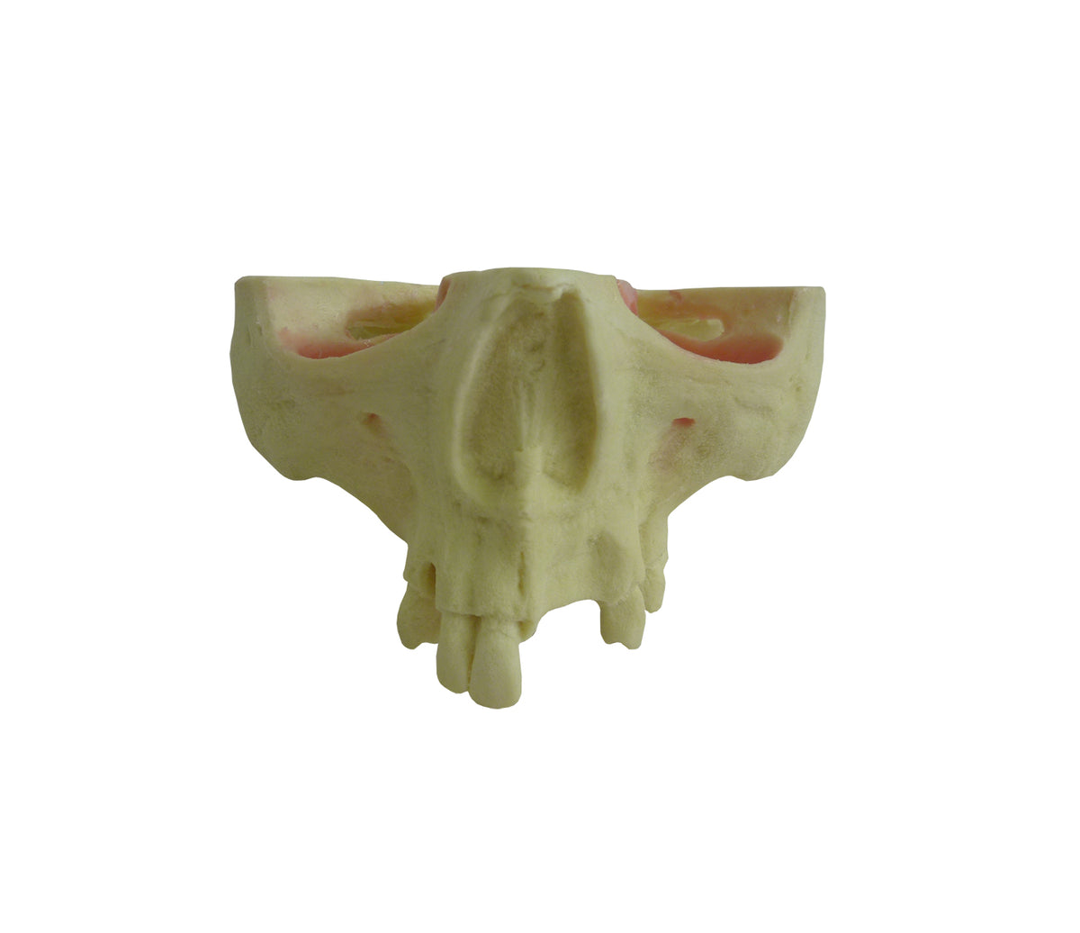 12295 - RADIOPAQUE MAXILLA WITH SOME TEETH