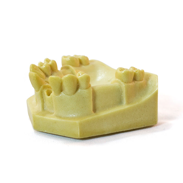 12310 - RADIOPAQUE MAXILLA WITH MISSING TEETH - SET 1