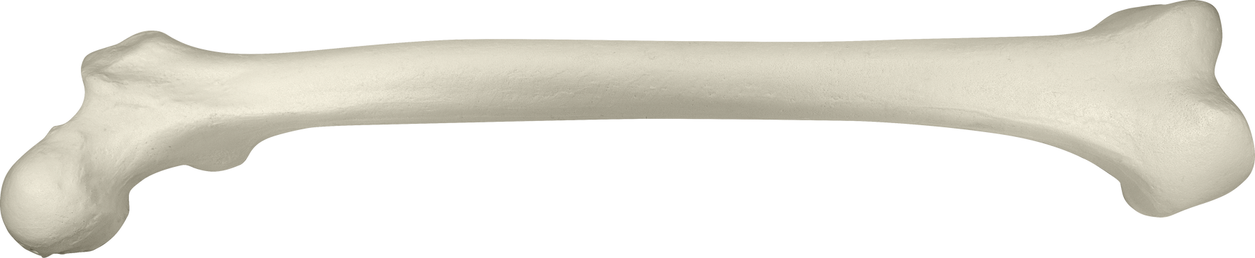 12368 - RADIOPAQUE LEFT FEMUR WITH CANCELLOUS MATERIAL AND MEDULLARY CANAL