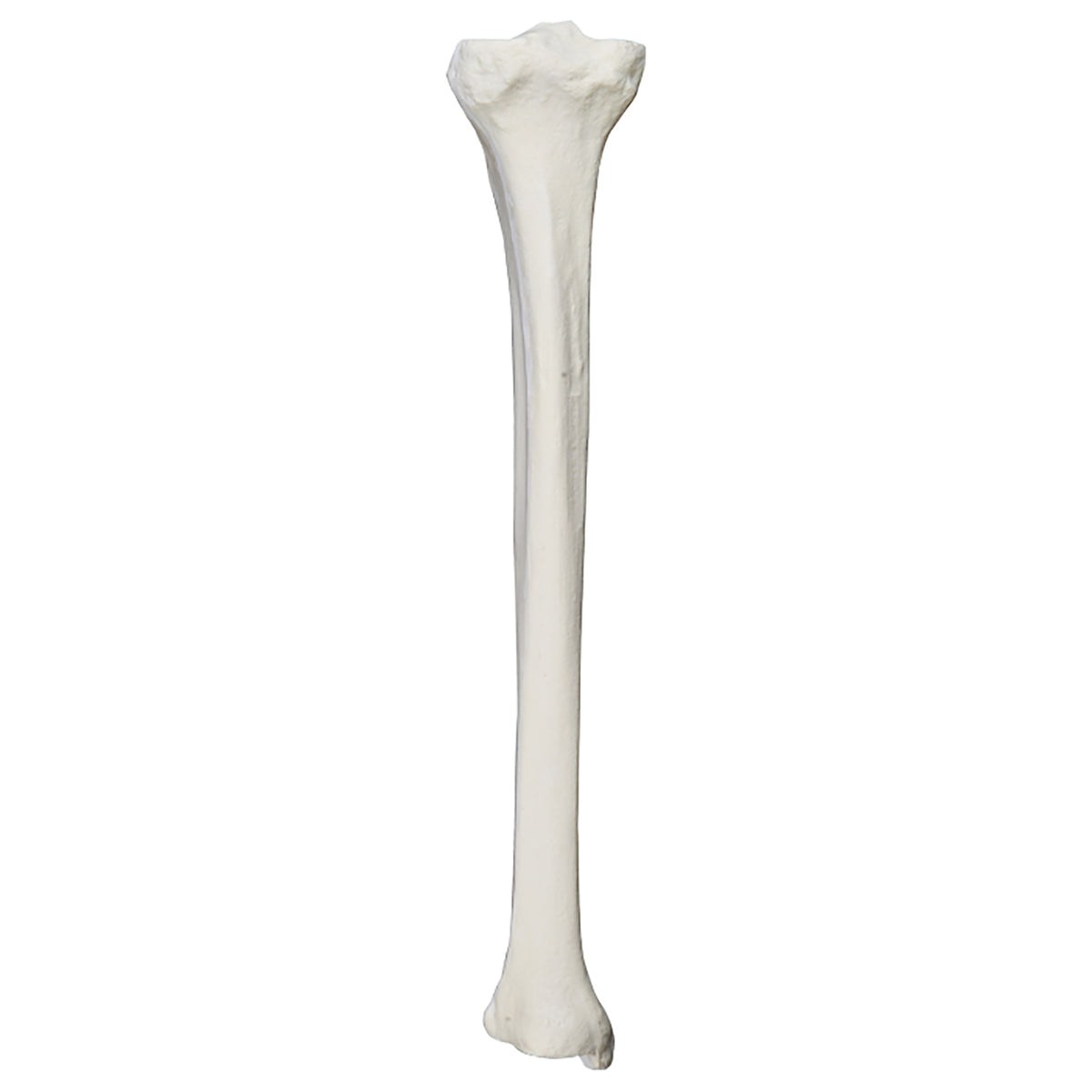 2026 - LEFT TIBIA