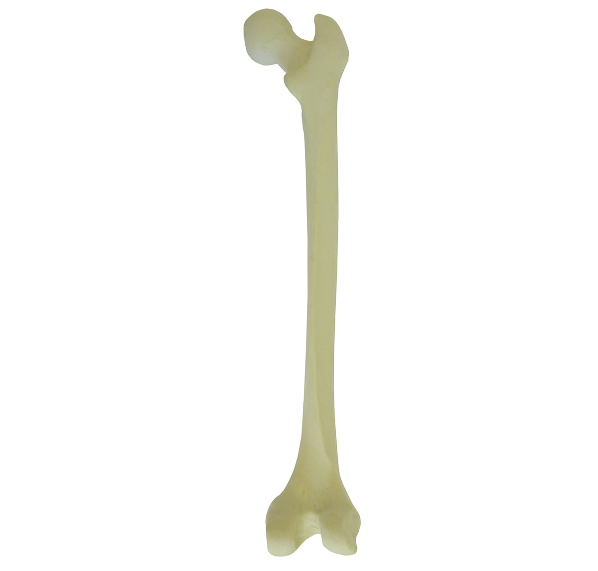 2030 - RIGHT FEMUR