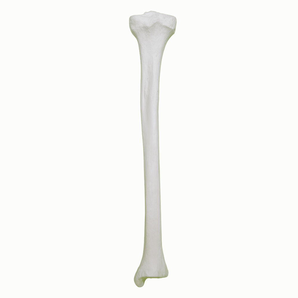 2031 - RIGHT TIBIA