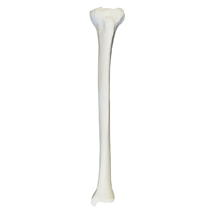2031B - RIGHT TIBIA WITH MEDULLARY CANAL