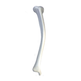 79 / 5 12434 - RIGHT RADIOPAQUE TIBIA WITH 2 PLANE MEDIAL POSTERIOR VALGUS DEFORMITY