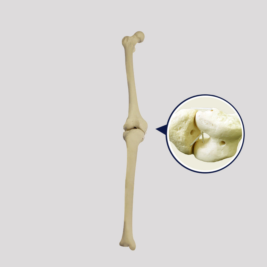 2040 BD - RIGHT KNEE WITH MEDULLARY CANAL AND LIGAMENTS SIMULATION