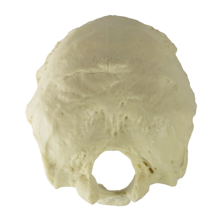4001 - OCCIPITAL
