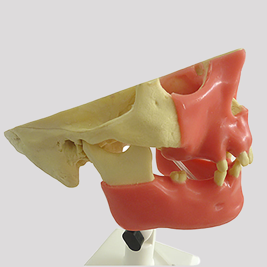 4005GT - PREMOLAR MODEL WITH GUM