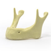 4010 - EDENTULOUS MANDIBLE