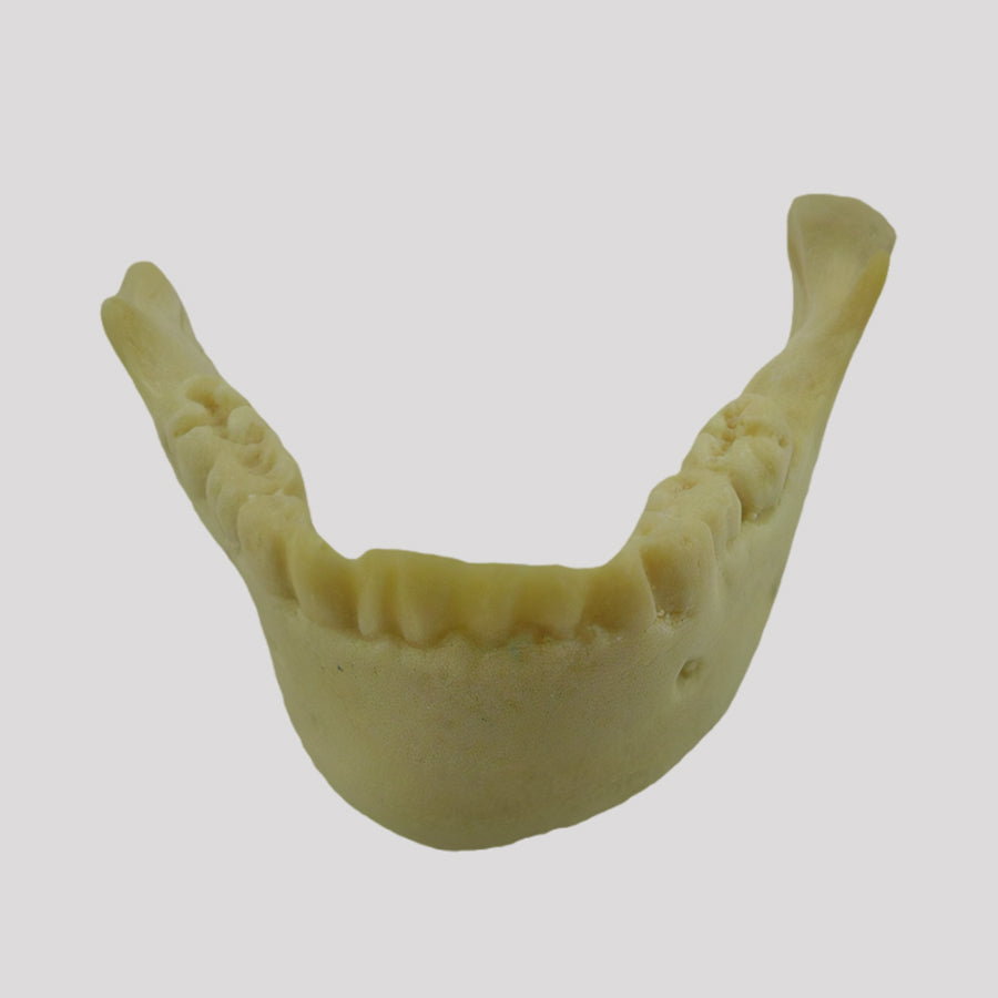 4013 - 2 - CHILD JAW WITH ALL THE TEETH AND DEFORMITY