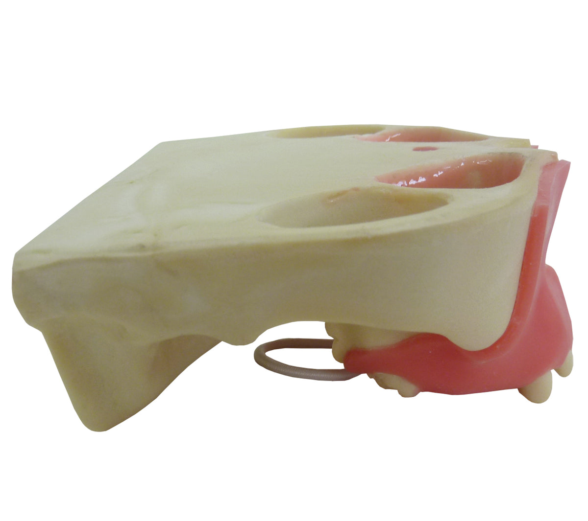 4015DIG - MAXILLA WITH 3RD MOLAR ENCLOSED AND GUM