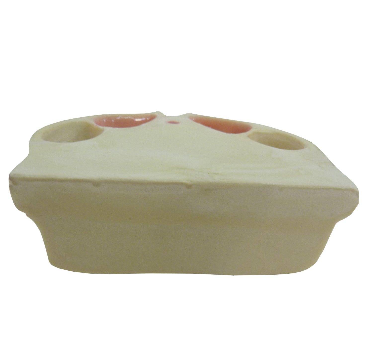 4015DIG - MAXILLA WITH 3RD MOLAR ENCLOSED AND GUM