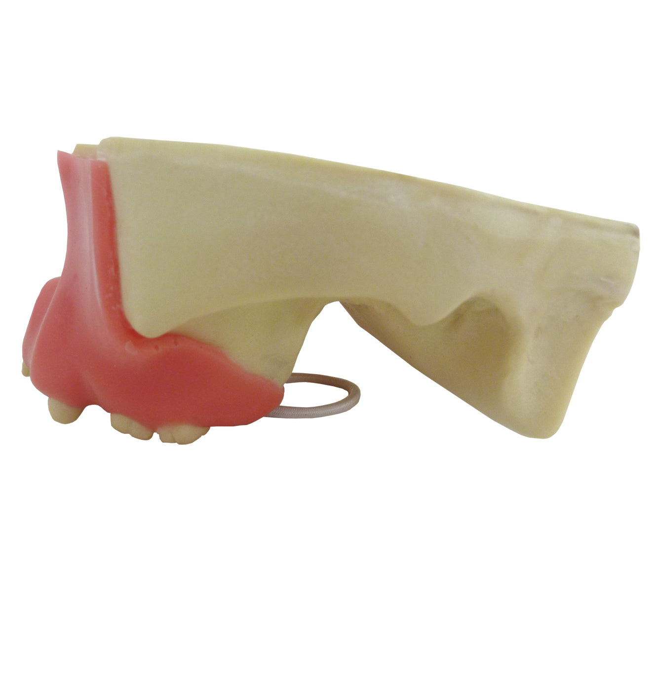 4015DIG - MAXILLA WITH 3RD MOLAR ENCLOSED AND GUM