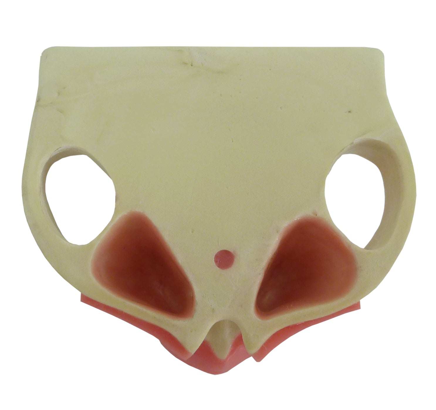 4015DIG - MAXILLA WITH 3RD MOLAR ENCLOSED AND GUM
