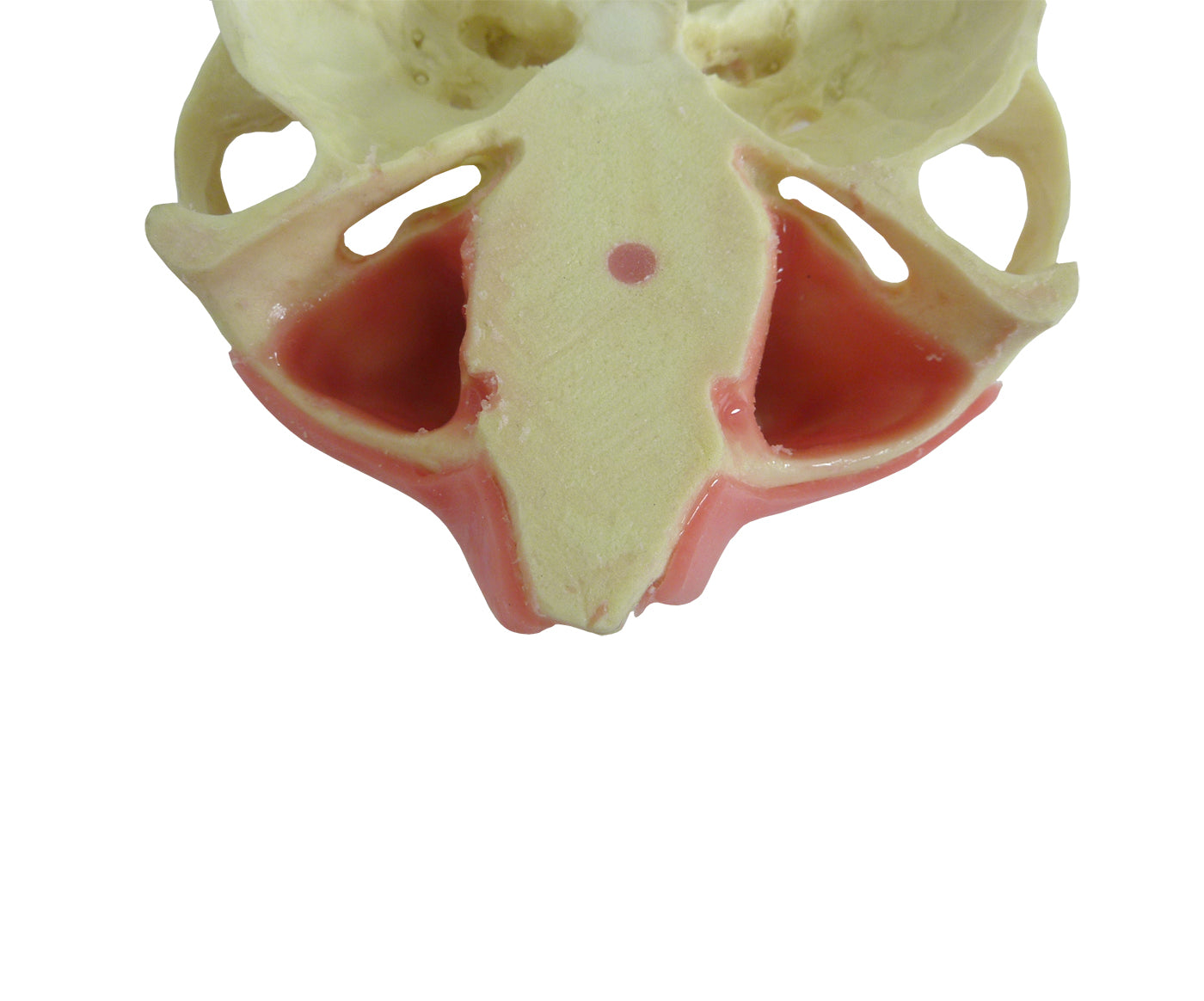 4015GT - MAXILLA WITH SOME TEETH AND GUM