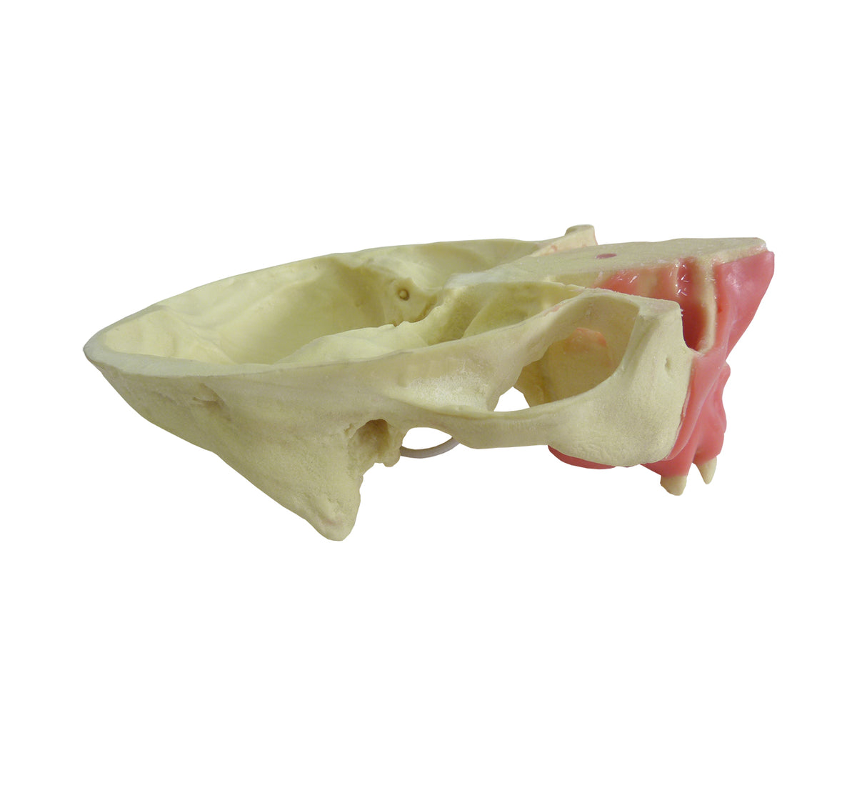 4015GT - MAXILLA WITH SOME TEETH AND GUM