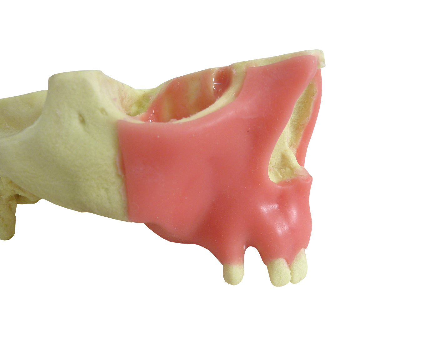 4015GT - MAXILLA WITH SOME TEETH AND GUM