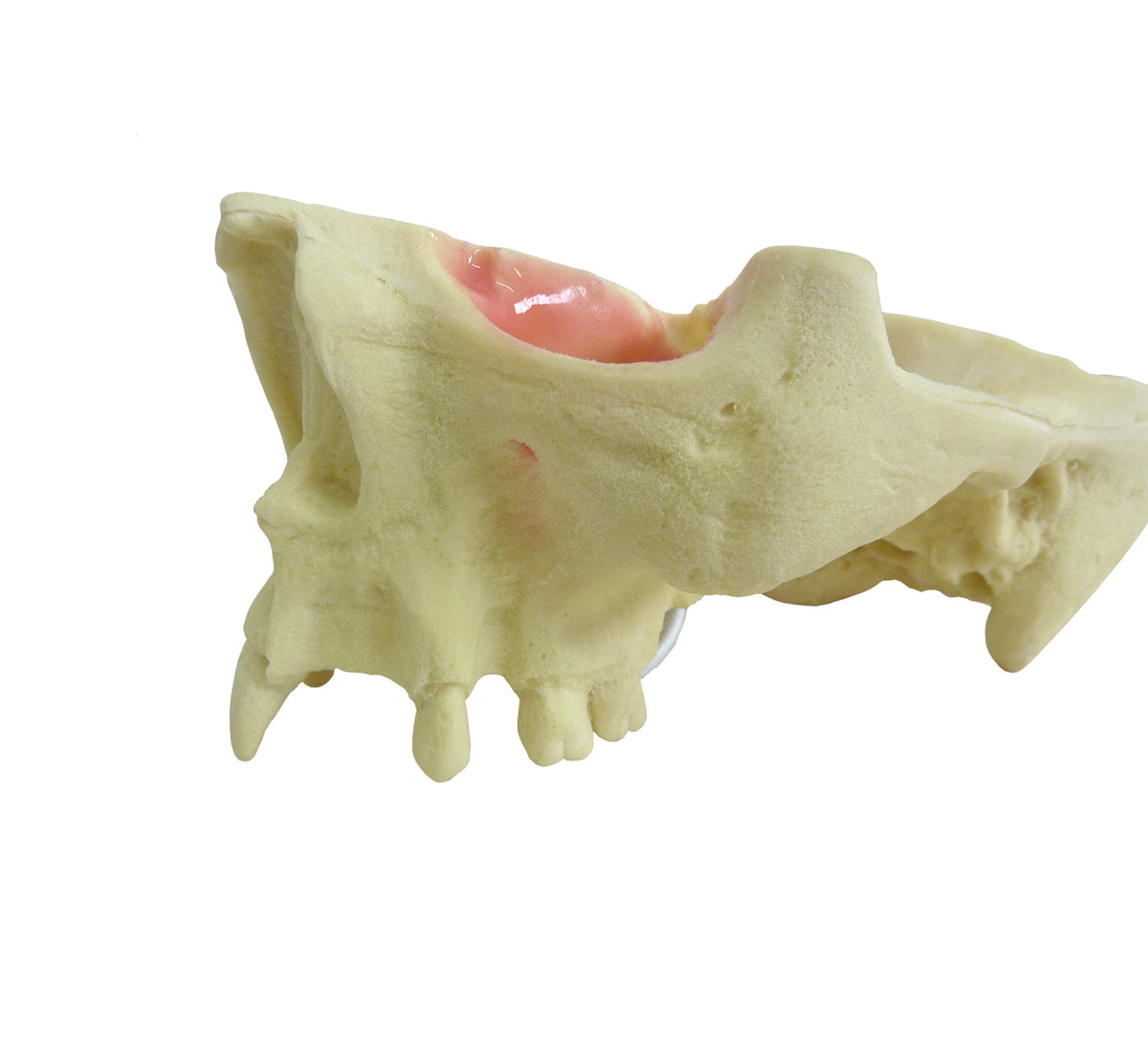 4015T - MAXILLA WITH SOME TEETH