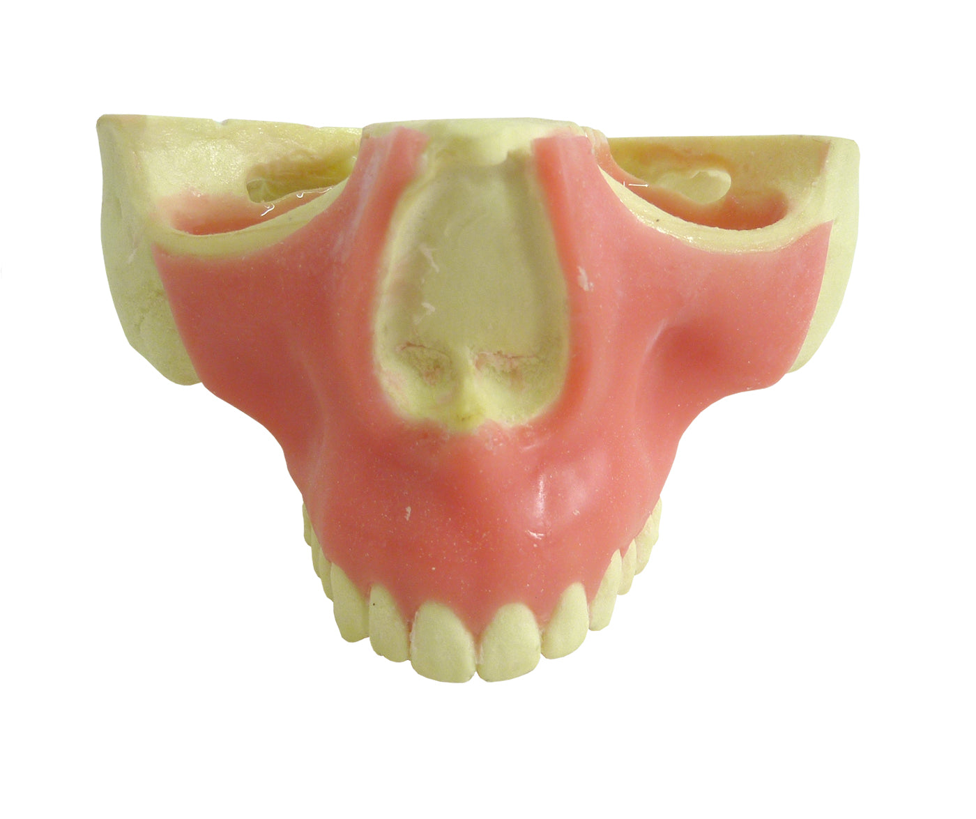 4016GT - MAXILLA WITH ALL TEETH AND GUM