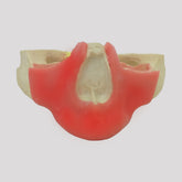 4017 GT - EDENTULOUS MAXILLA WITH GUM