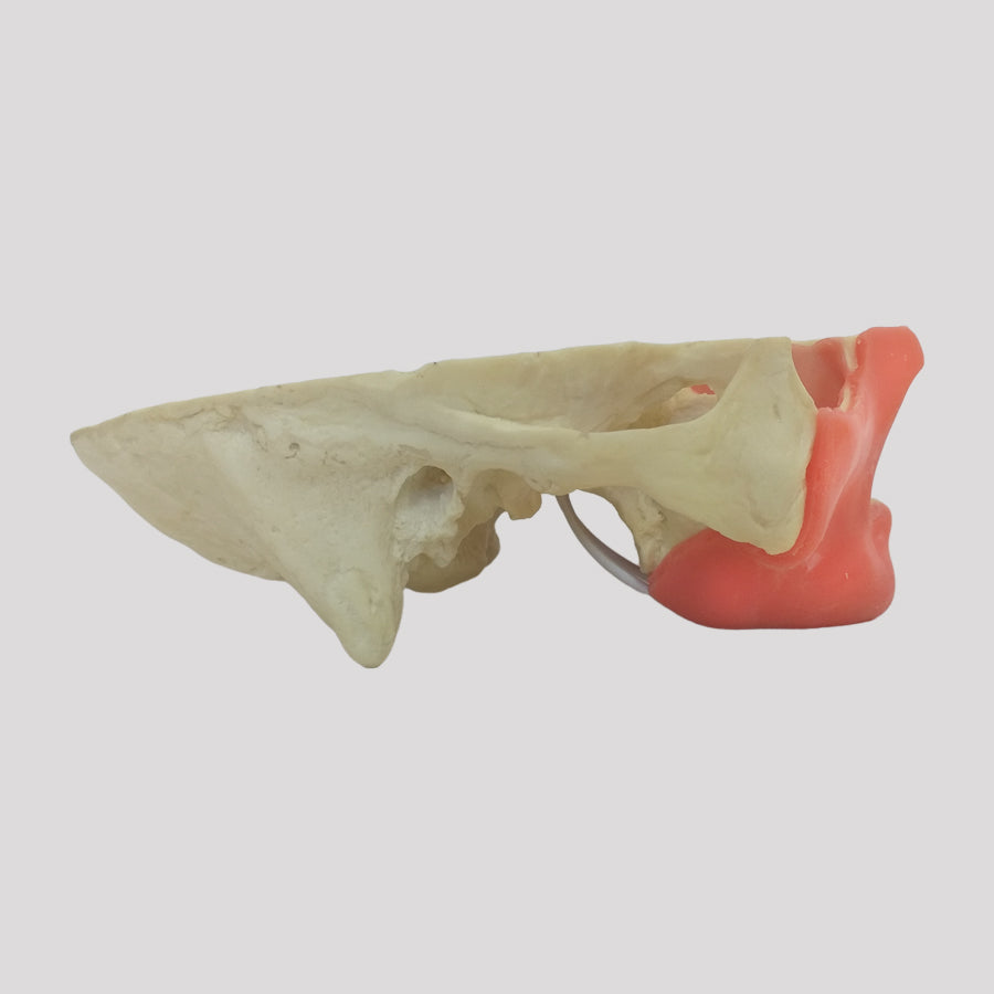 4017 GT - EDENTULOUS MAXILLA WITH GUM