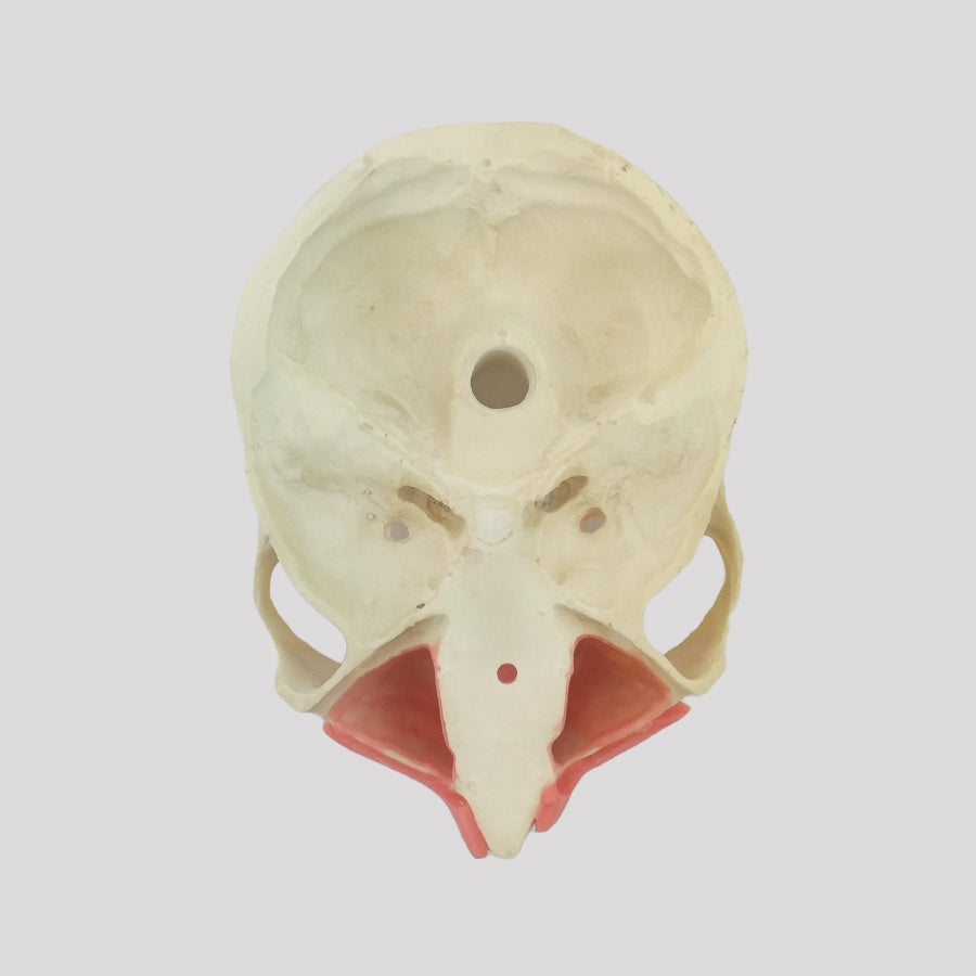 4017 GT - EDENTULOUS MAXILLA WITH GUM