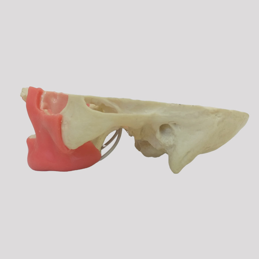 4017 GT - EDENTULOUS MAXILLA WITH GUM