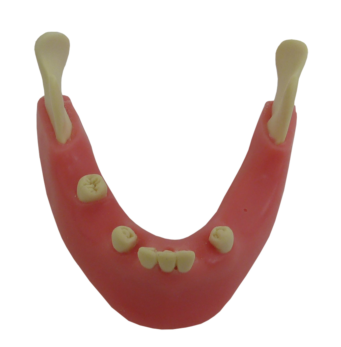 4401G-02 - PREMOLAR MODEL WITH ENCLOSED 3RD MOLAR AND GUM